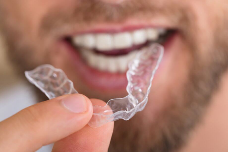 The Cost of Invisalign vs The Cost of Braces